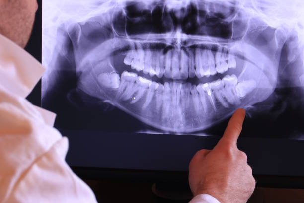 Best Emergency Treatment for Oral Infections in Thermalito, CA