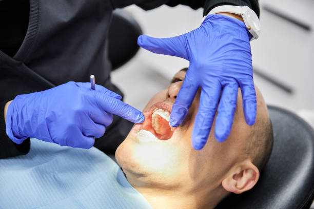Best Broken or Chipped Tooth Repair in Thermalito, CA